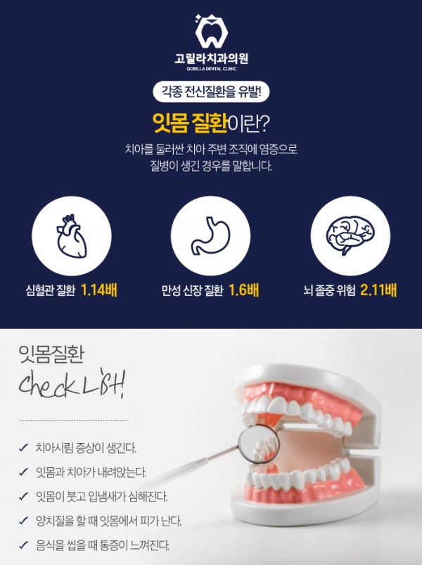 역북동잇몸치료를 통증 적게 진행하는 고릴라치과! 이미지 2