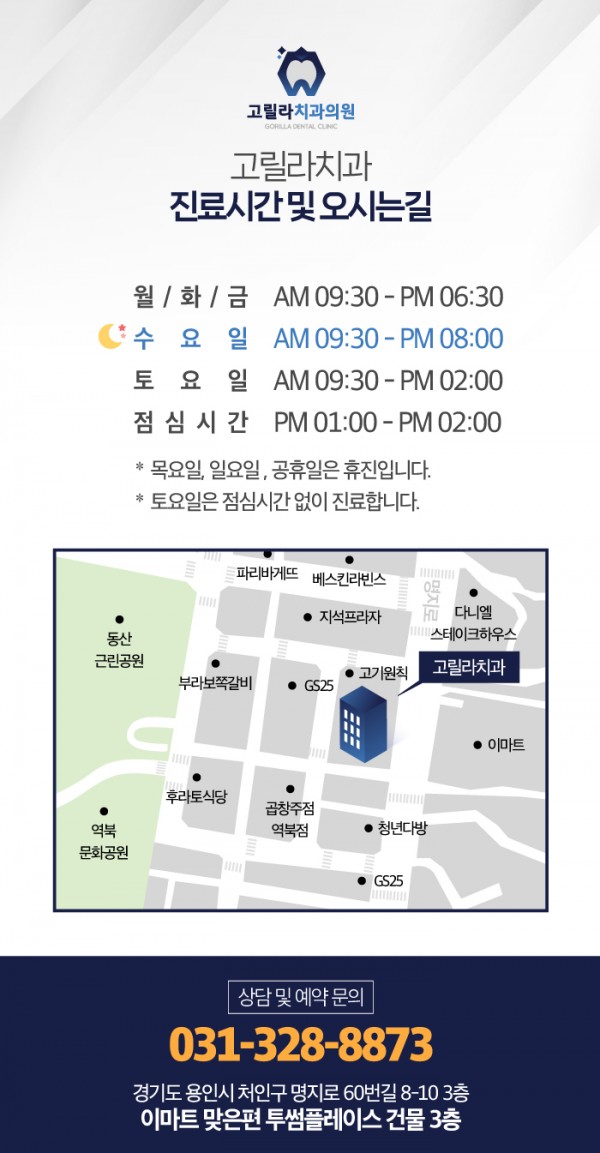 무삭제 라미네이트 이미지 7