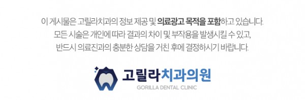 치주염으로 인한 앞니 브릿지 치료 이미지 13