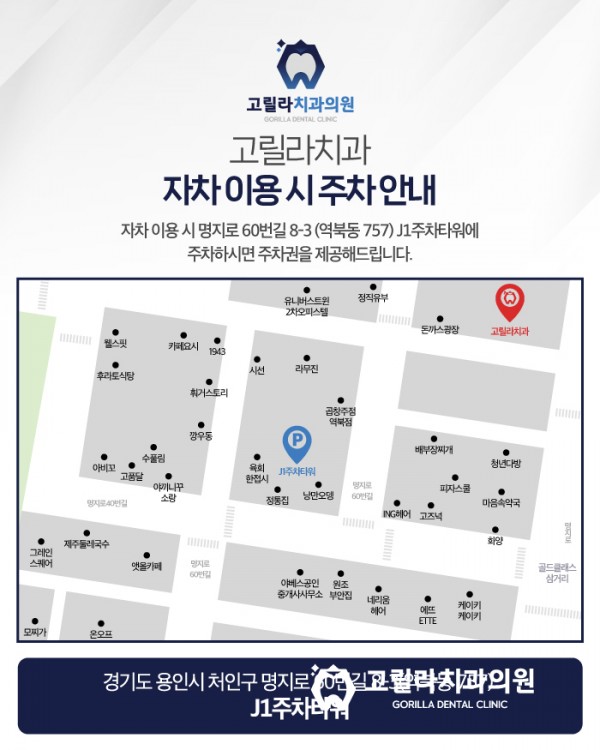 치주염으로 인한 고난이도 임플란트 수술 이미지 19