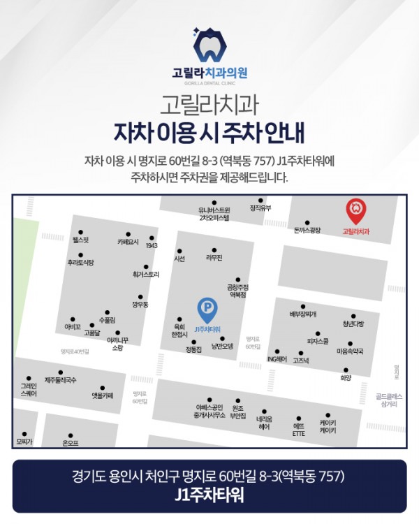 치실중요성 - 신경치료 , 크라운 보철치료 이미지 18