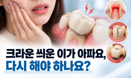 크라운 치료 후 통증, 다시 해야 하는 경우와 아닌 경우｜용인치과 역북동치과