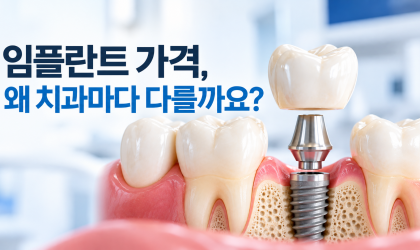 임플란트 가격, 치과마다 왜 다를까요?