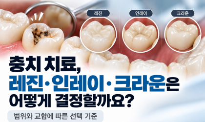 충치 범위별 레진·인레이·크라운 선택 기준｜용인치과 역북동치과